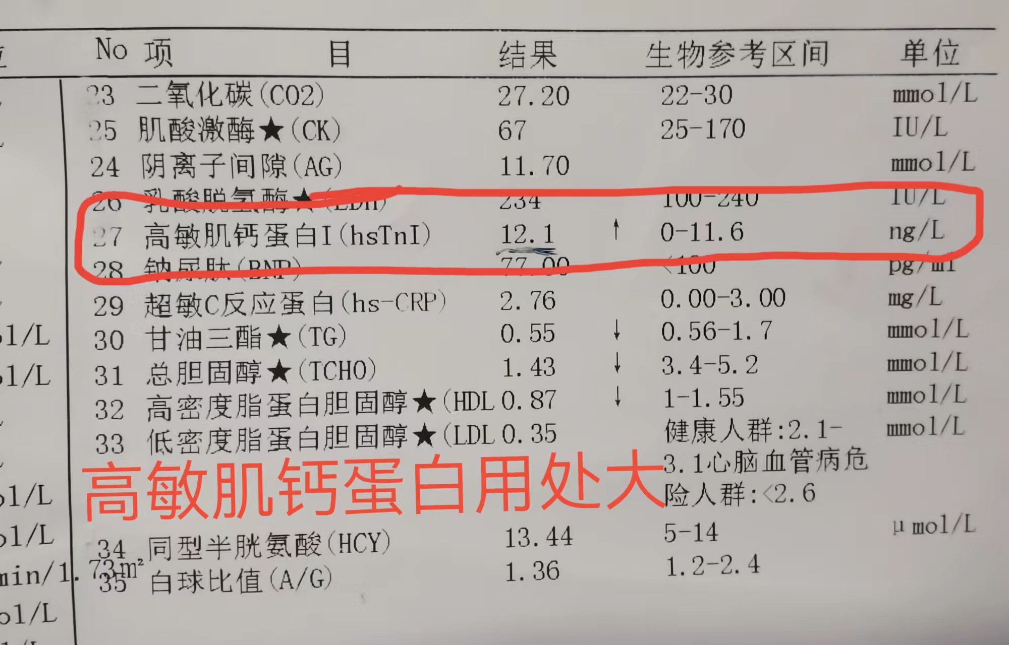 高敏肌钙蛋白需要停药监测吗,高敏肌钙蛋白结果1430正常吗