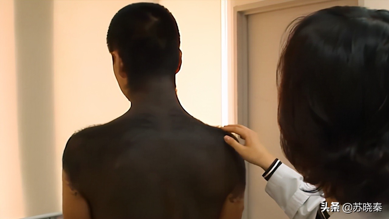 小伙背上长痣,男子背上有痣好不好