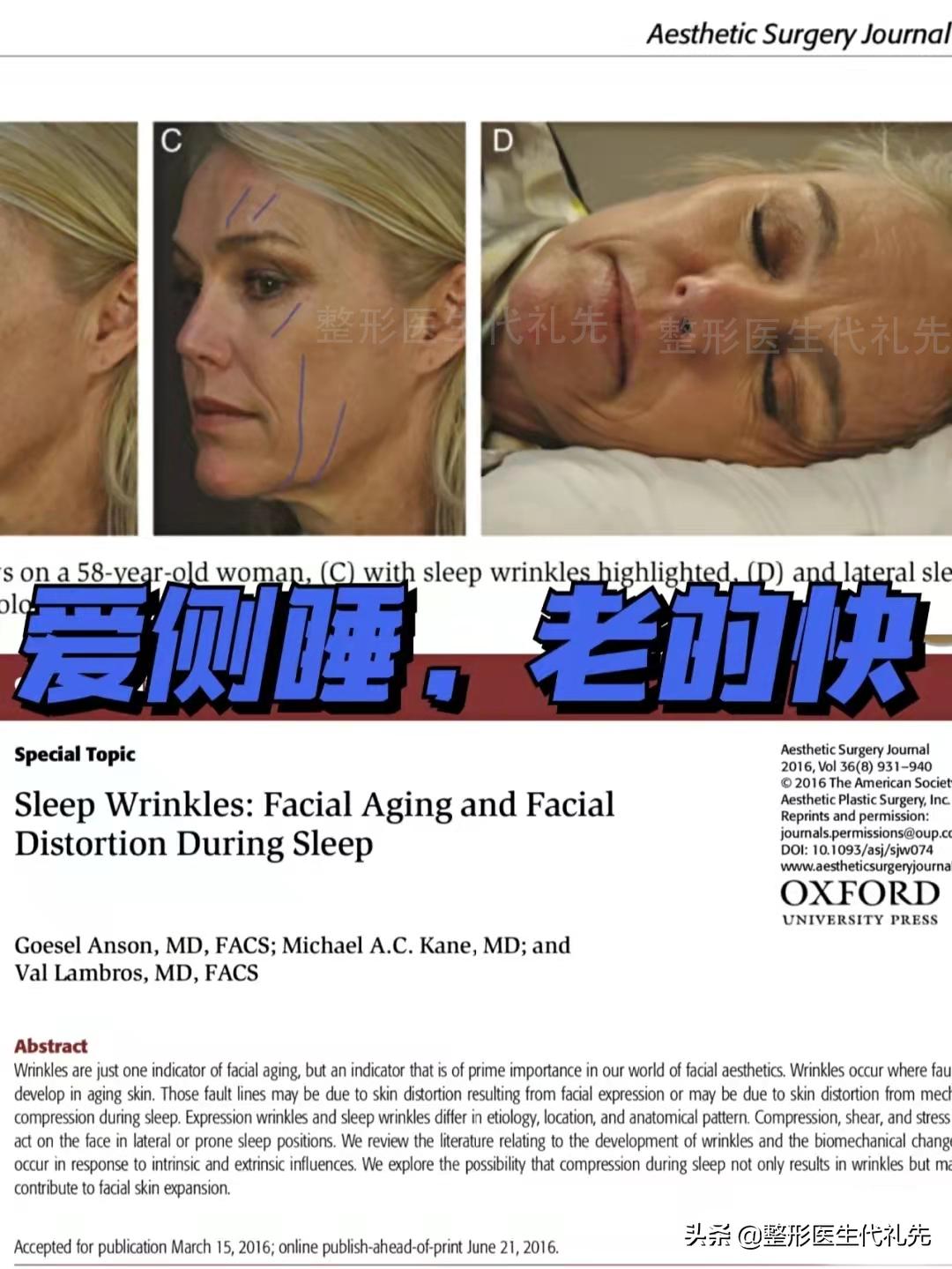 侧睡的危害大怎么治疗,侧睡伤脸部皮肤