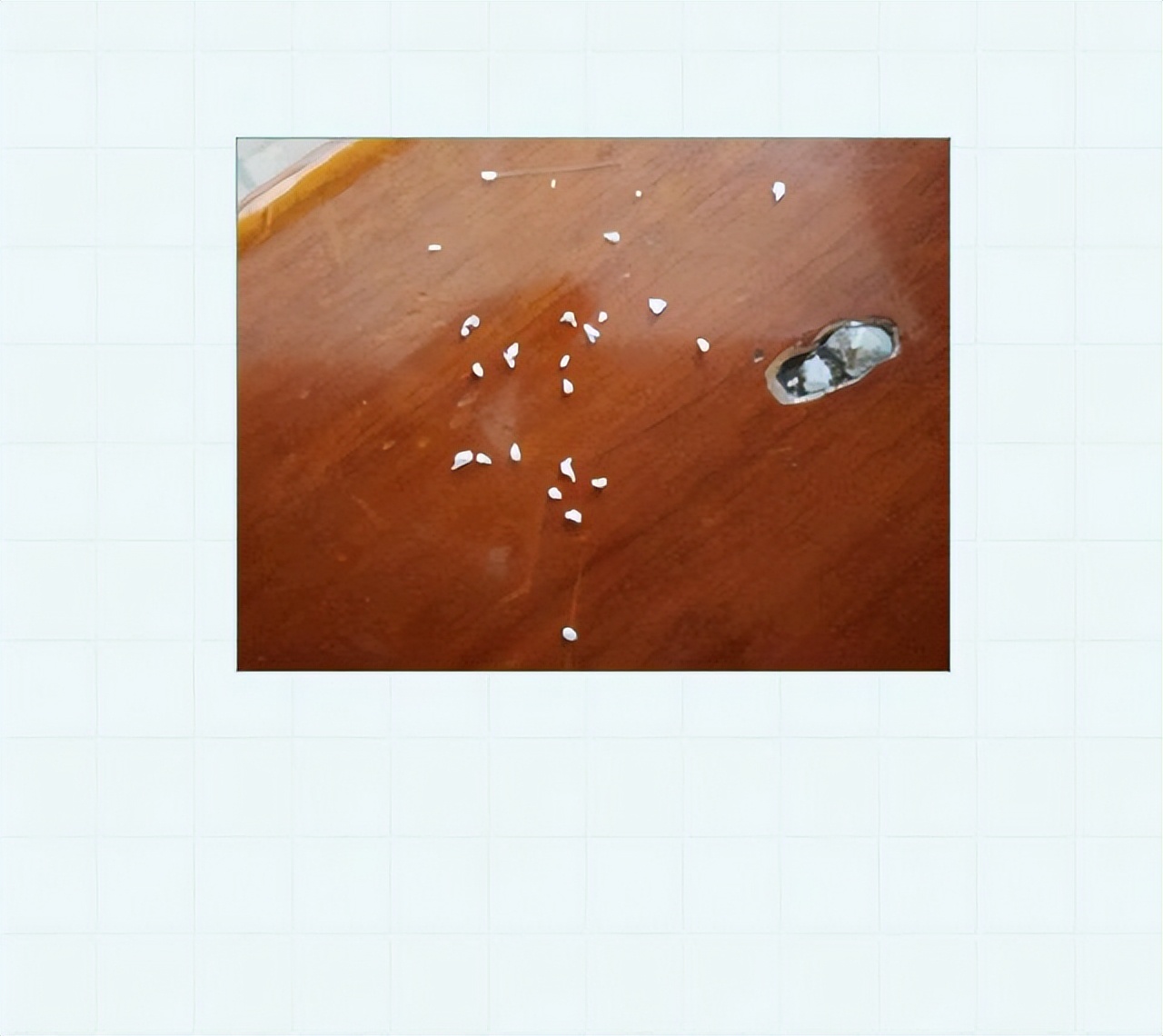 头皮上的白色颗粒,头皮上的白色颗粒是虱子吗