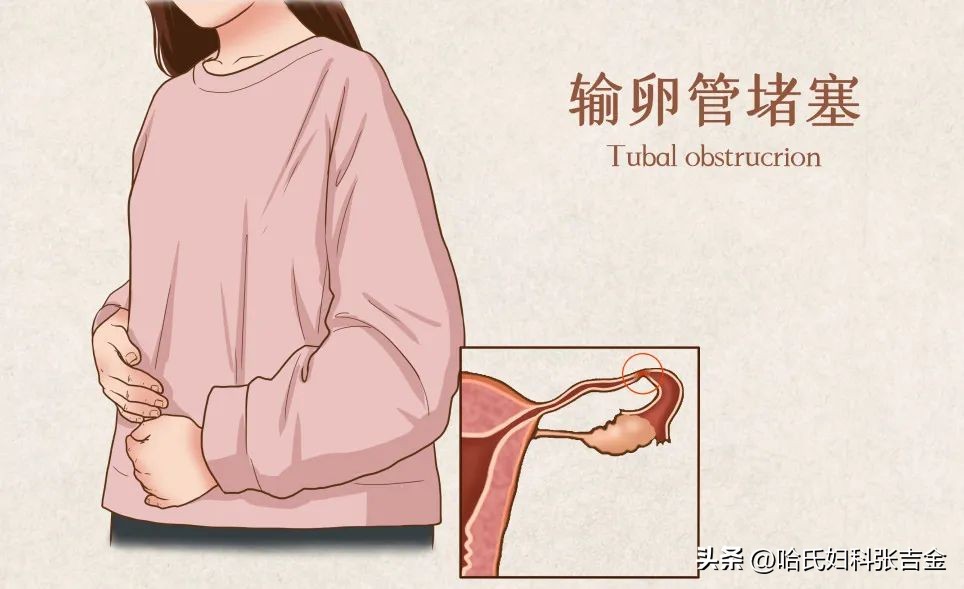 备孕很久了一直怀不上怎么回事,备孕半年怀不上需要做哪些检查