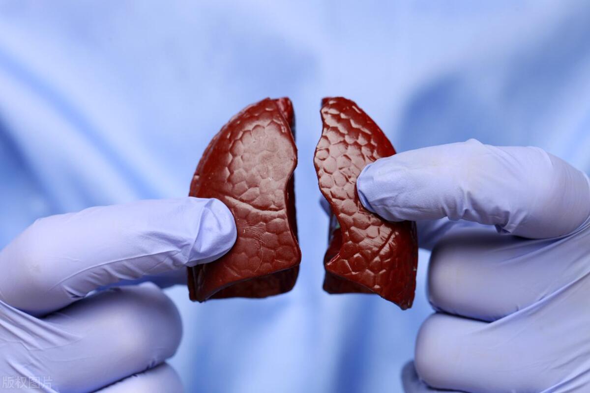 老公肺癌晚期，前天亲吻时，我突然嘴里咸咸的，老公吐痰了？