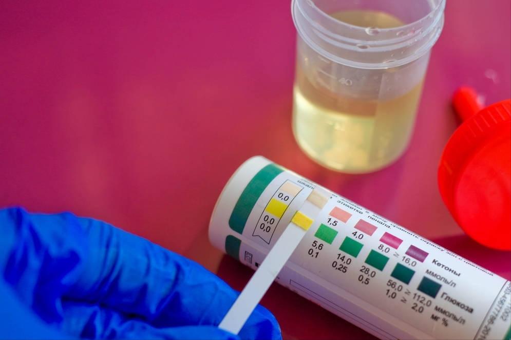 肾病尿蛋白高会转变成尿毒症吗,高血压肾病蛋白尿1g多久到尿毒症