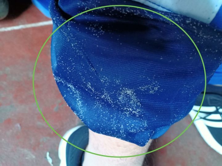 身上老是洗不干净是怎么回事,洗完澡皮肤干痒起白皮屑怎么回事