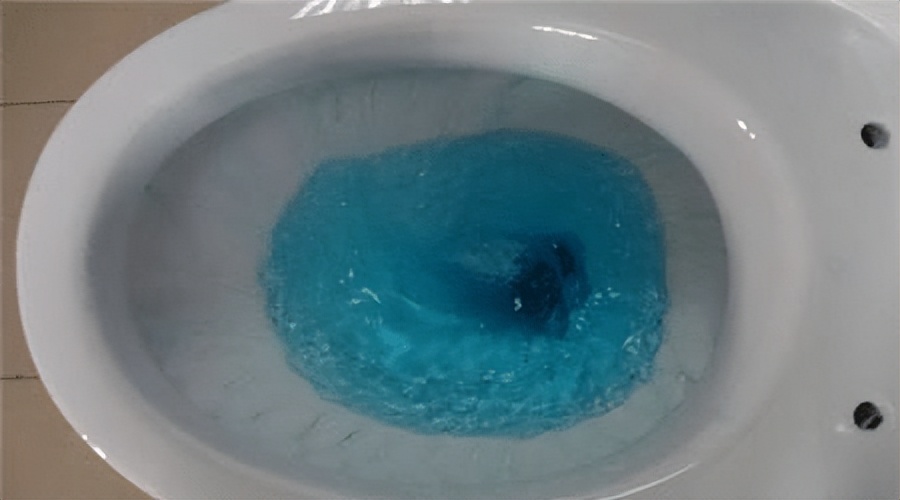 马桶上厕所老是被溅到水,不小心碰到马桶水怎么办