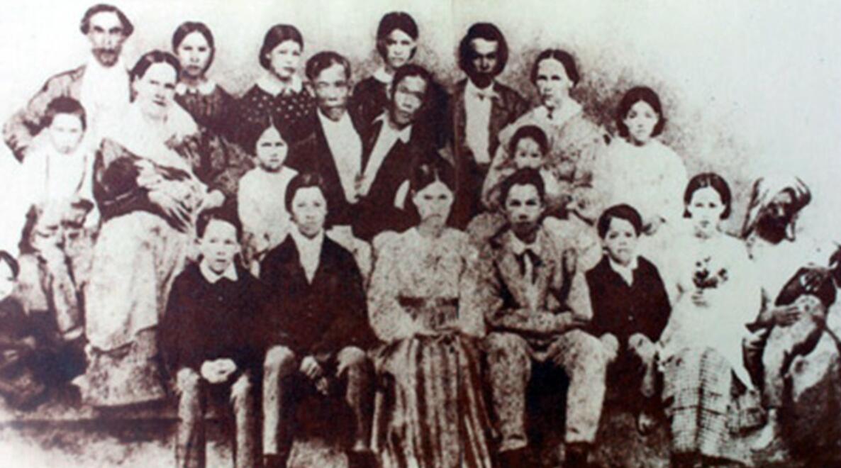 连体人该怎么结婚生子,邦克兄弟连体人