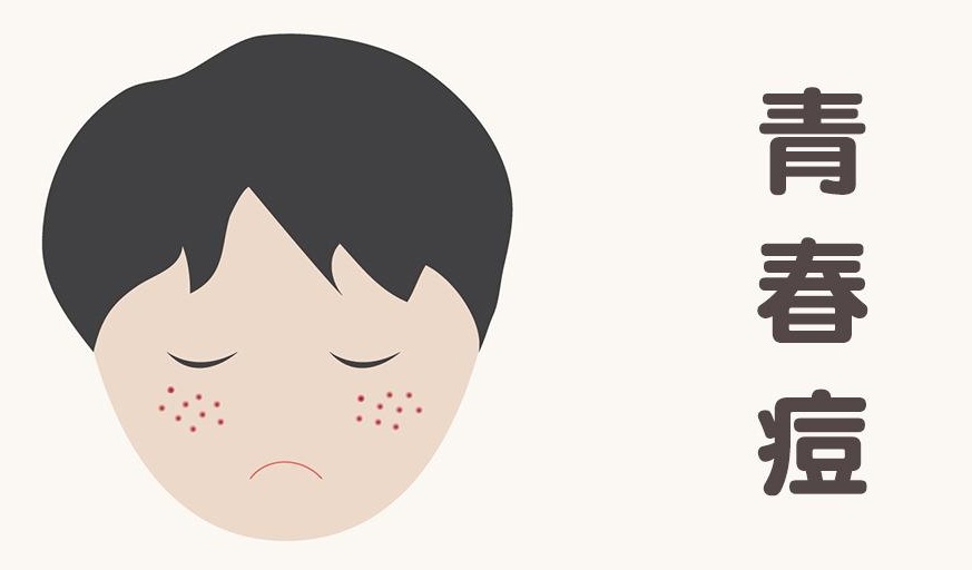 治痘痘的药异维a酸副作用,治痤疮吃异维a酸胶囊副作用