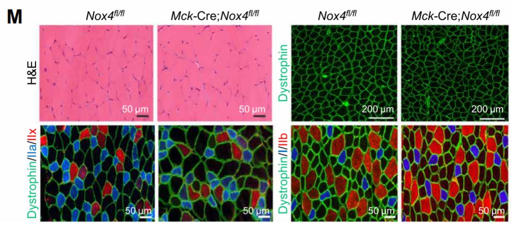 缓解衰老最好灵丹妙药,怎样才能延缓衰老加强细胞更新