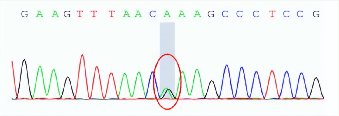 徐州市儿童医院呼吸二科,儿童呼吸介入科的设备