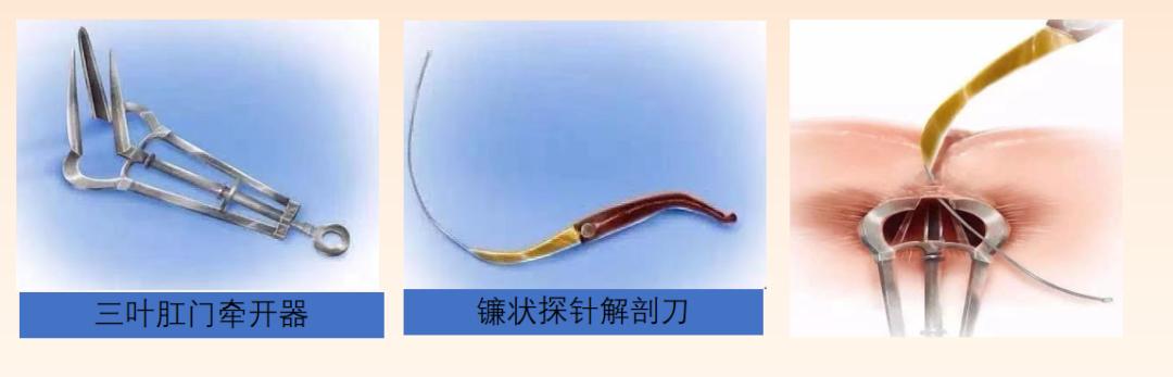 别说你会擦屁屁！43岁衢州大哥因这里没清理干净，住院了！