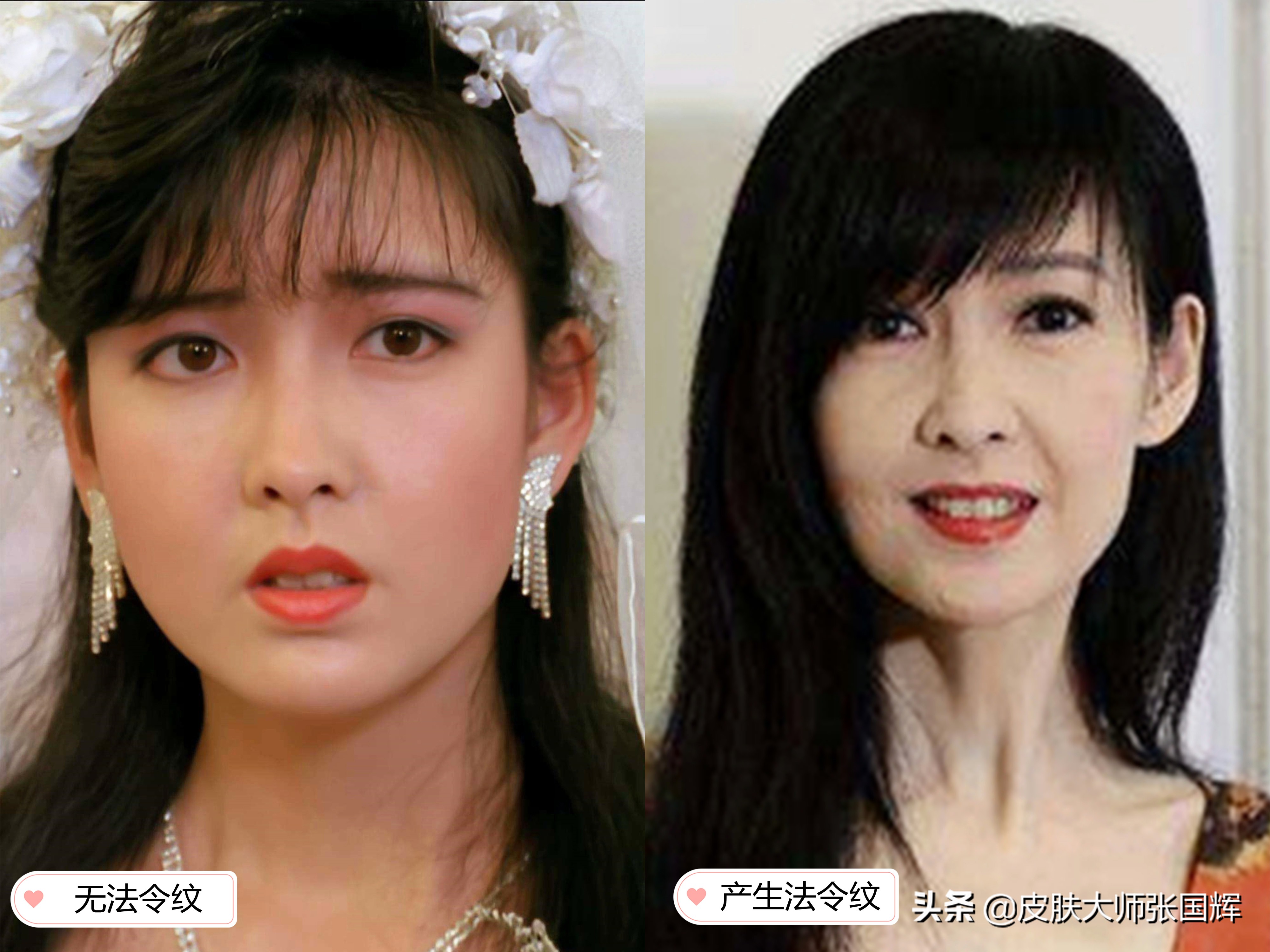 法令纹显老10岁试试这个新办法,法令纹这么显老得如何搞定