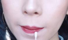 虽然知道她对丰唇很执着，但美女不要再乱折腾了