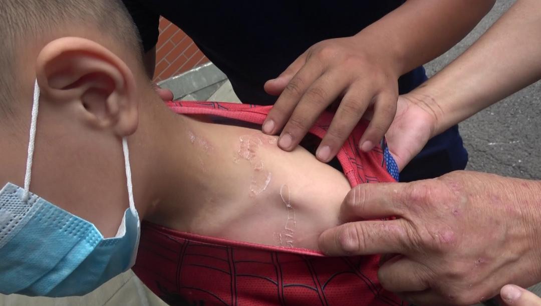 小孩不慎被502粘住了怎么办,502粘住手了消防员的做法