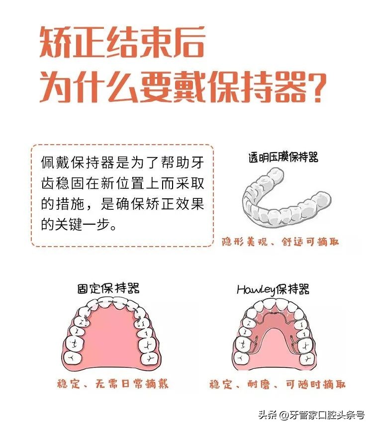 戴隐形矫正牙套注意事项,什么时候戴矫正带是最佳时间