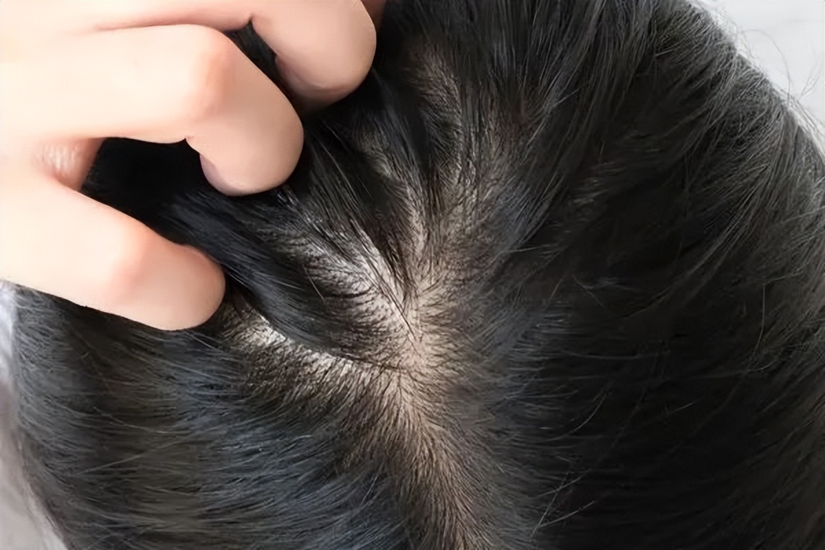 最简单的白发食疗方法,早生白发吃什么最有效