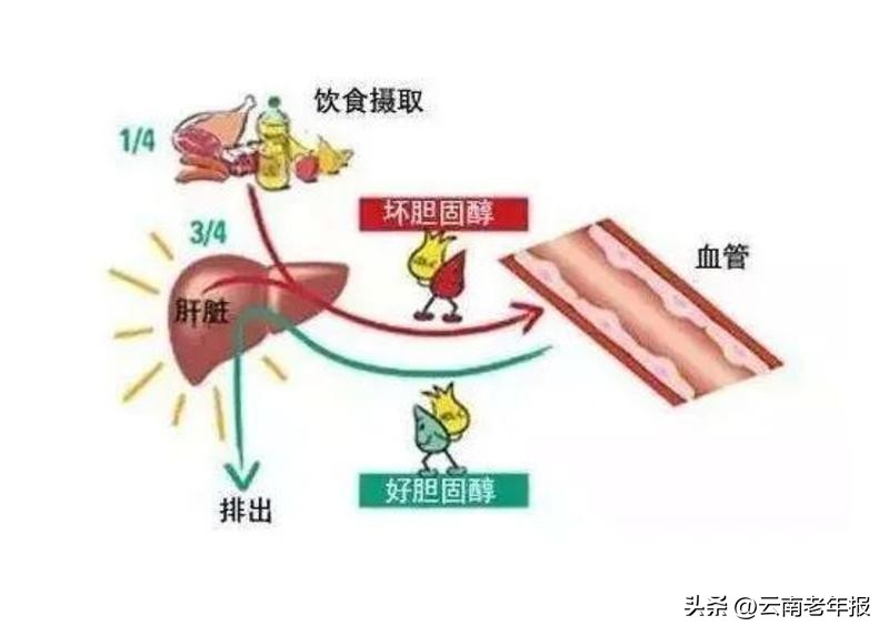 胆固醇高了怎么办有什么注意事项,胆固醇高了怎么办注意什么