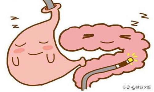 国际护胃日浅表性胃炎,胃有问题的胃镜检查全过程