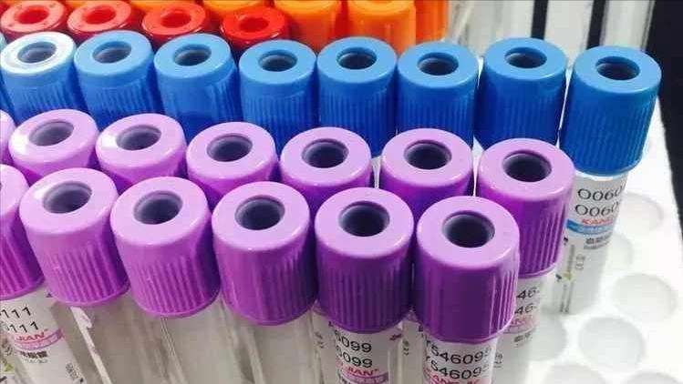 现在看病为什么动不动就要验血,医院里验血抽的血最后都去哪里了