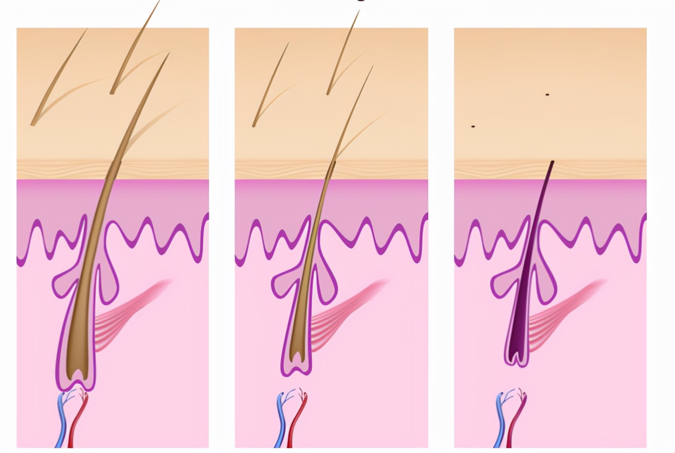 预计到2023年，头发克隆市场将达到240亿美元