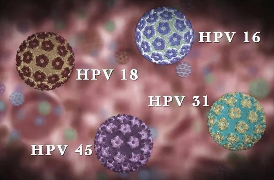 48岁女子确诊宫颈癌，子宫全切，身体这4处异常变化，别再忽视！