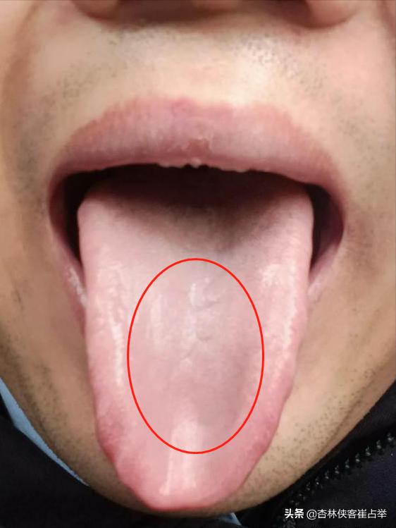 从养生角度看舌头应该放哪,补脾胃最好的舌头图解