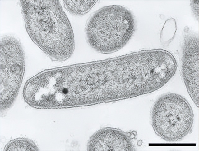 肠道菌群由哪些细菌组成,深度分析肠道细菌