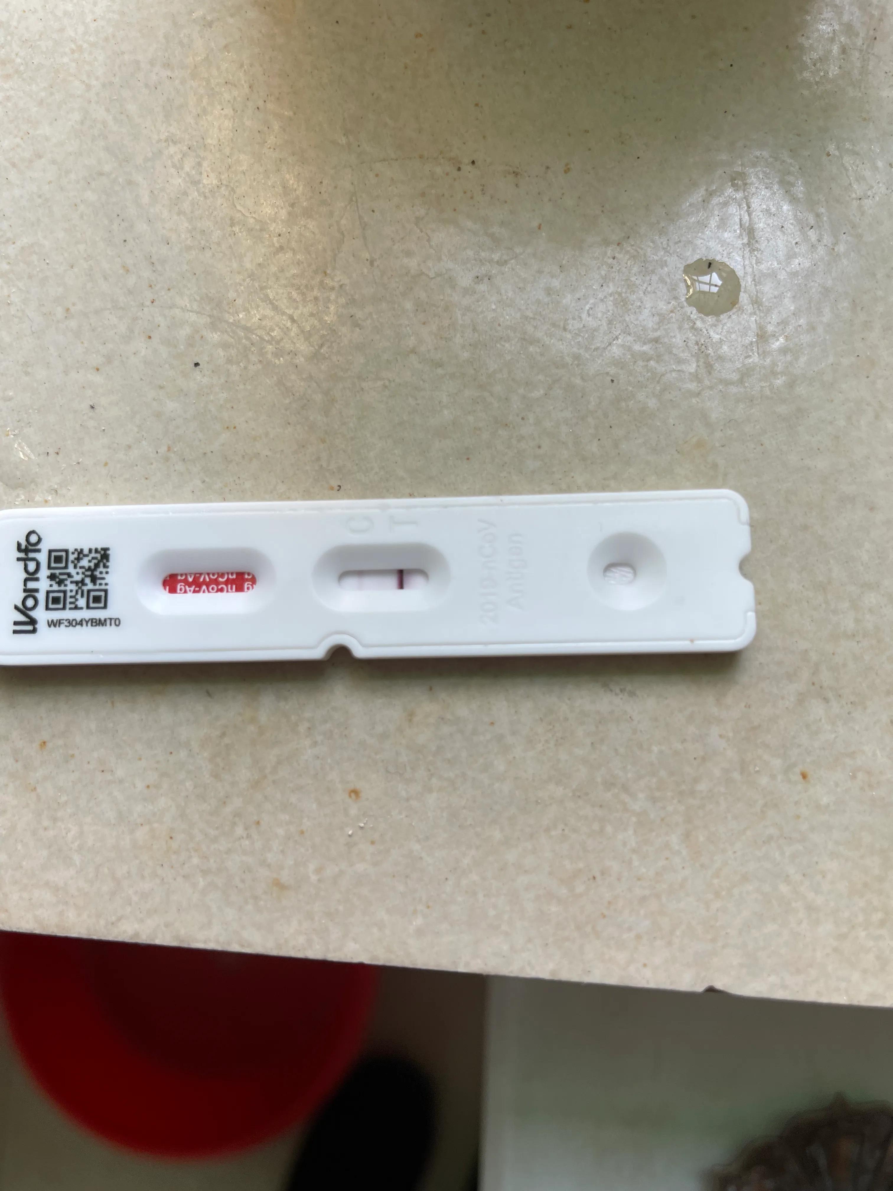 慢性肾炎感冒发烧了怎么办,慢性肾炎感冒发烧后尿液发红