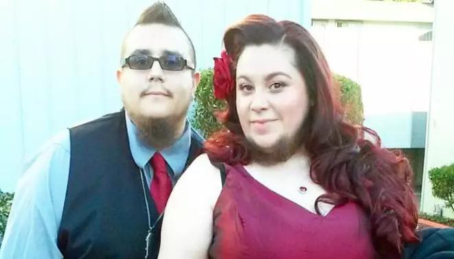 女性长胡子怎么办食疗,女人内分泌失调长胡须会长毛发吗