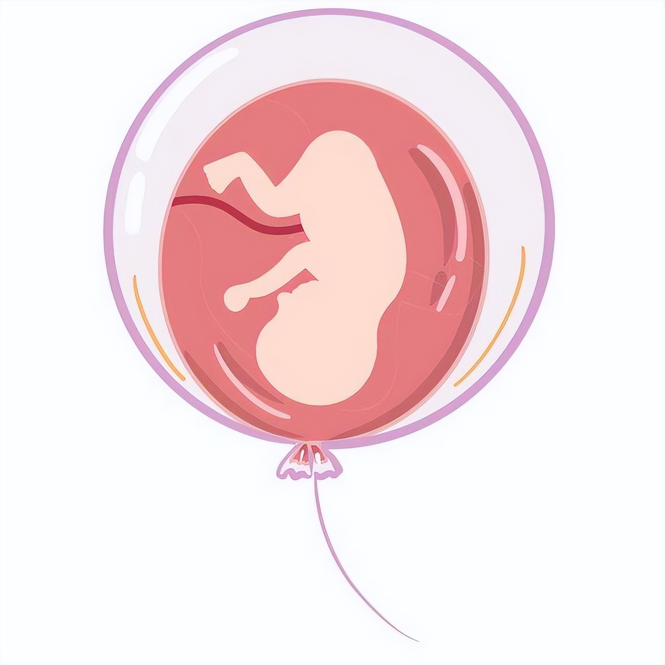 孕妈打个喷嚏就把宝宝生出来了,打个喷嚏会流产吗