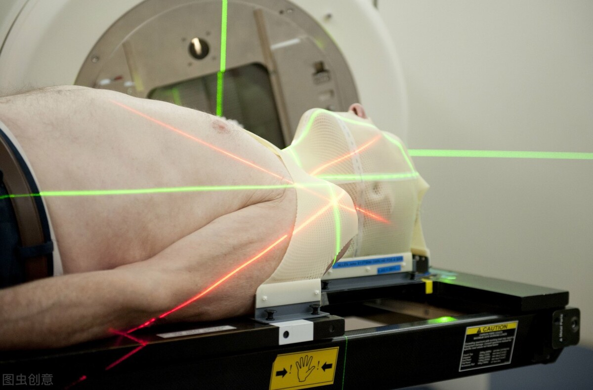 什么是放疗动画版,什么是放疗放疗怎么做