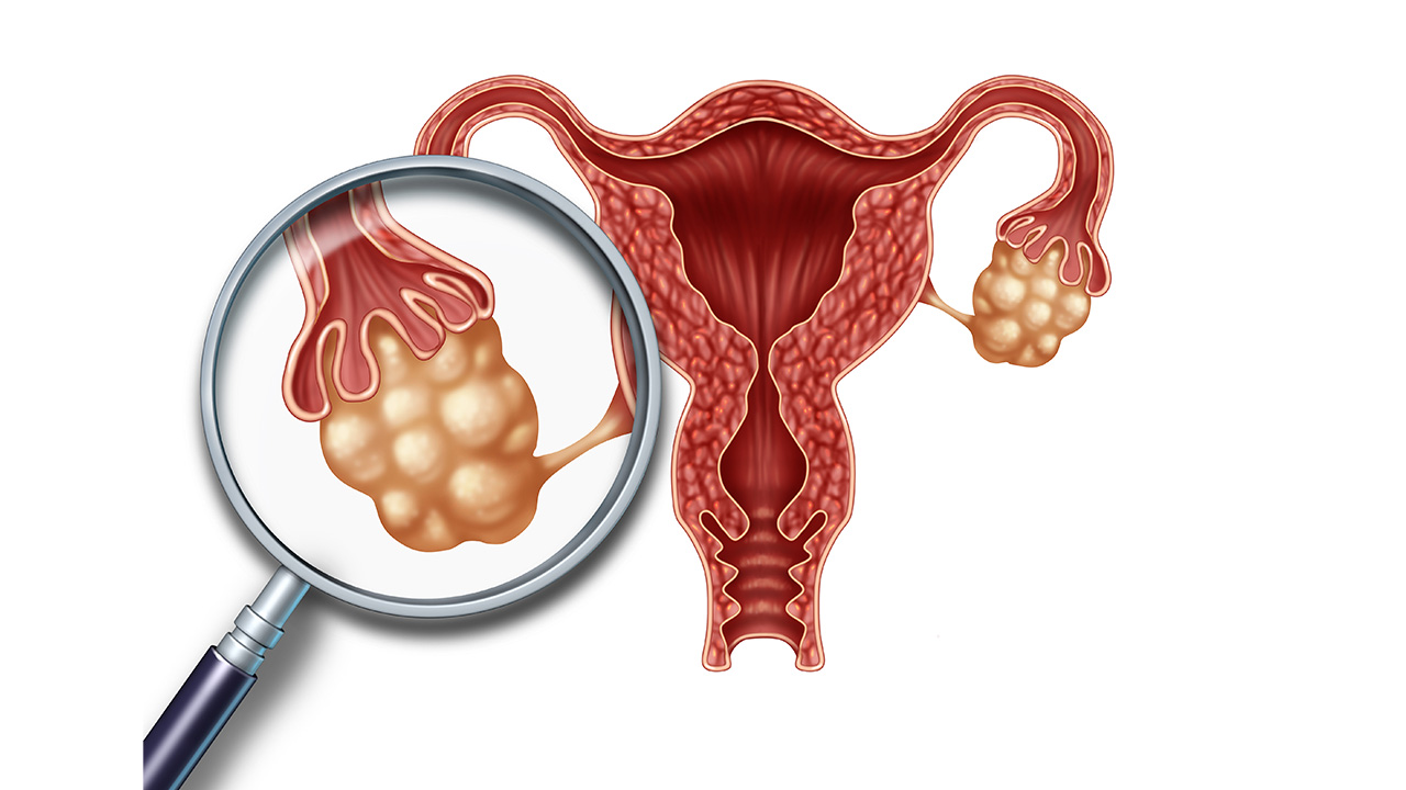 子宫内膜增厚乳房胀痛,子宫内膜增厚引起乳房胀痛吗
