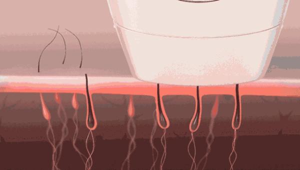 你必须知道的24个护肤技巧,医生建议脸部护肤方法