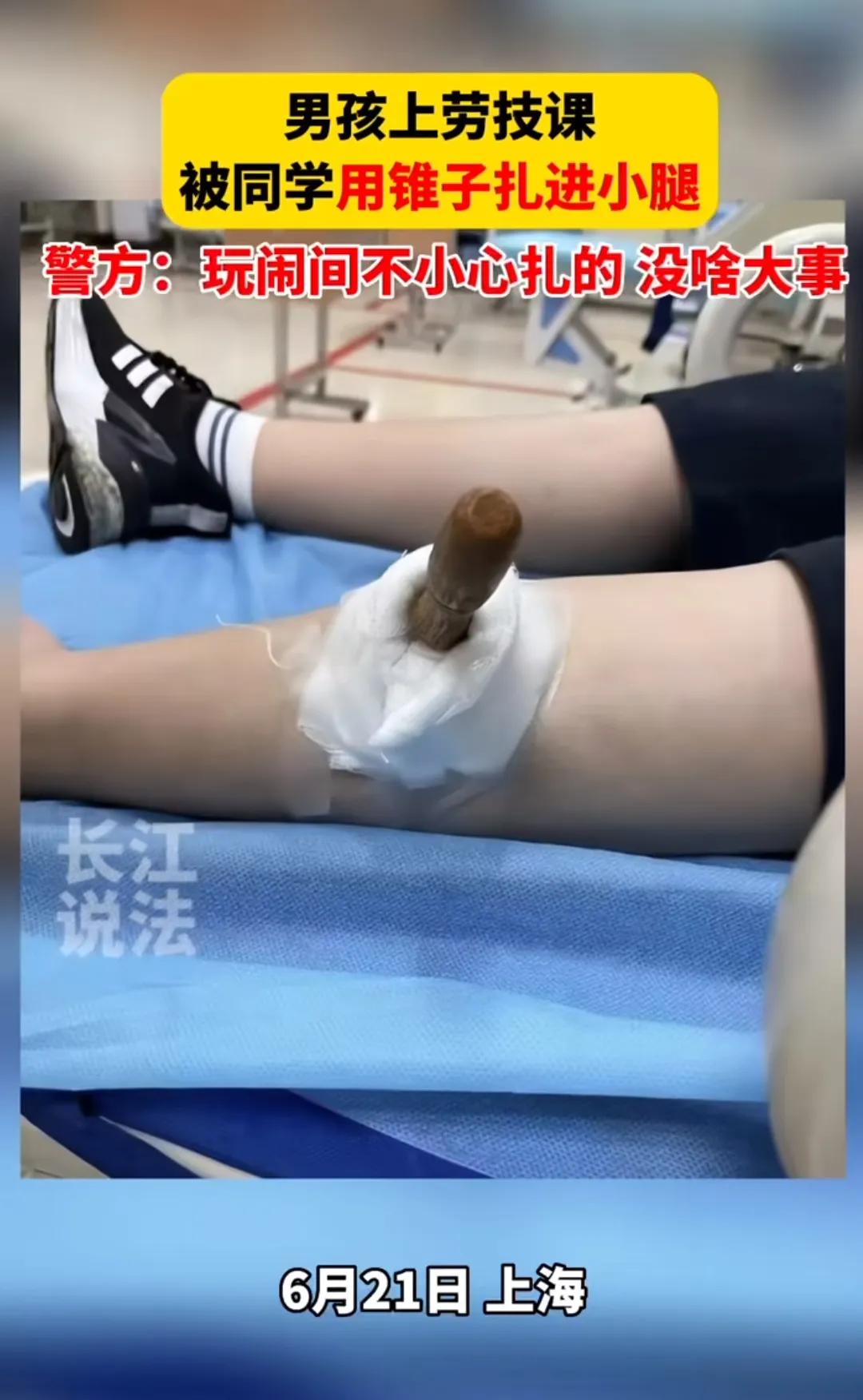 小学生被铁锥扎进小腿,上海小学生被铁锥扎腿