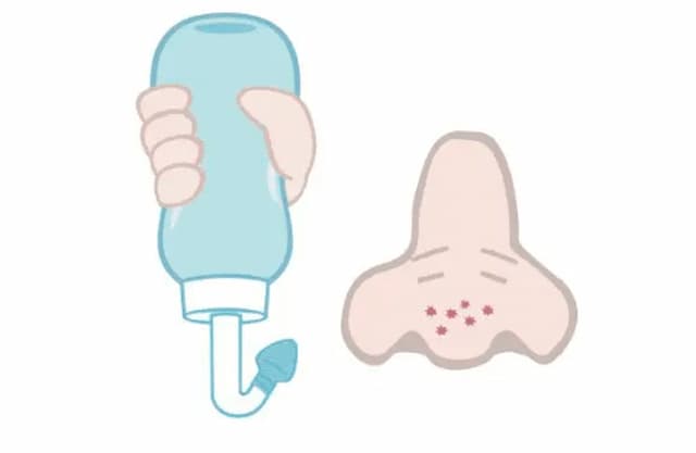 鼻炎鼻塞常年不通气小妙招,鼻炎鼻子堵塞不通气偏方