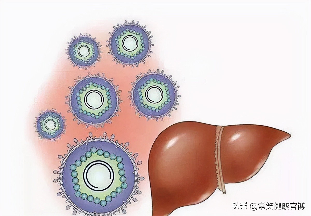 肩膀疼痛竟然也是肝癌的症状,左右肩膀痛与肝癌早期有什么关系