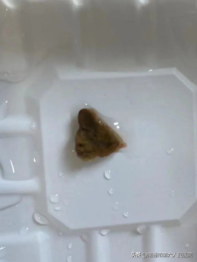 小镜子，大用途，一探究“镜”