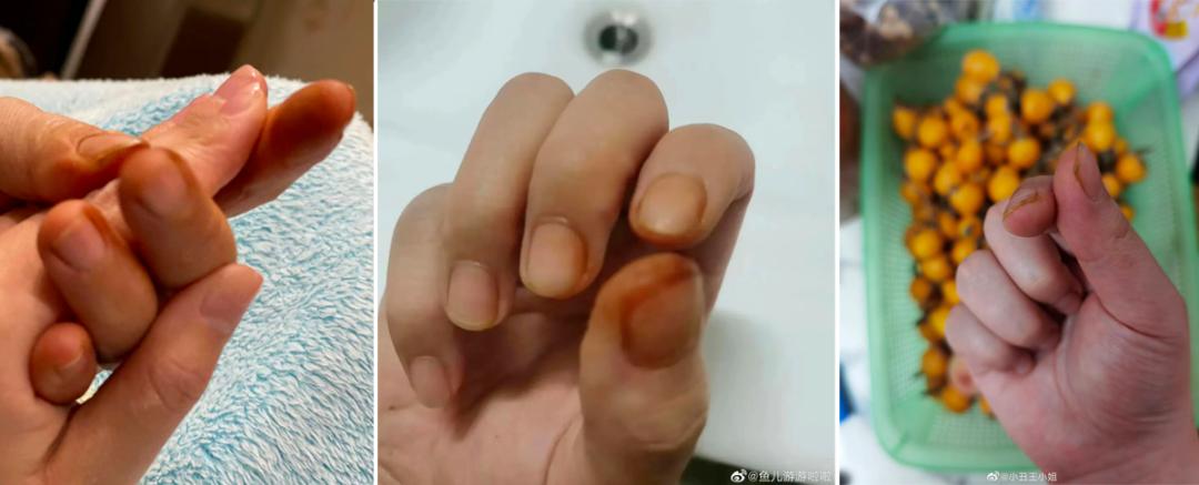 澶忓ぉ閫傚悎鍋氱殑鎵嬫寚鐢茬綉绾㈡,澶忔棩鎵嬫寚鐢叉寮忕綉绾㈡