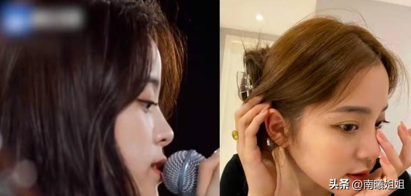 蒜头鼻却很漂亮的原因,蒜头鼻是真的影响颜值