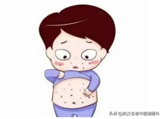 腰部半圈出疙瘩痒是怎么回事,腰部上很痒红的一片是怎么回事