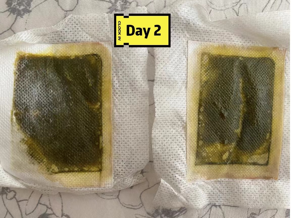 足贴真的可以祛湿气吗减肚子吗,老北京足贴变黑真的排湿气吗