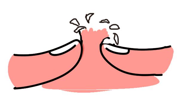 女生挤痘痘导致面部感染怎么办,女生挤痘痘导致面部感染