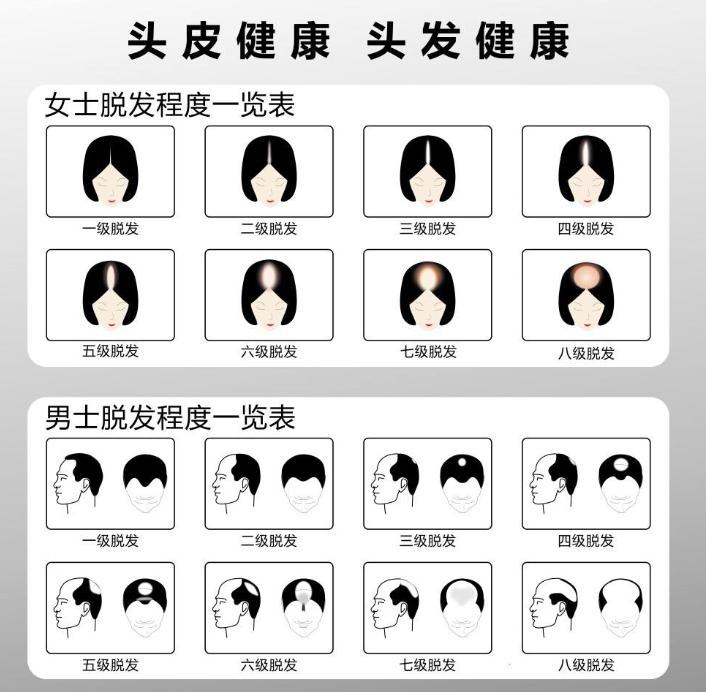 假发正确的测量长度方法,怎样选假发的规格尺寸