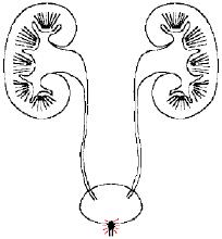 揭秘输尿管结石的治疗方法,输尿管结石都有哪些治疗方法