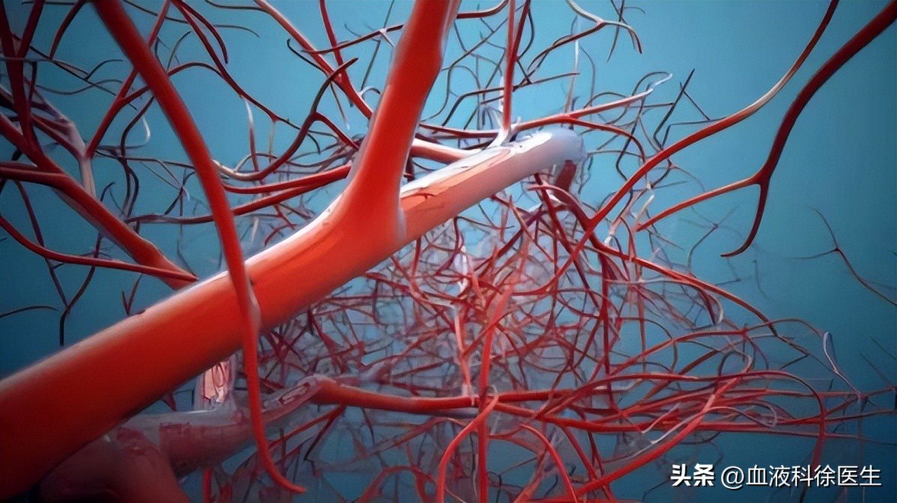 血栓来临腿部先知,血栓病手脚有什么症状