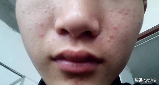 26年前，南阳人张毅的美容论文在《中医外治杂志》发表