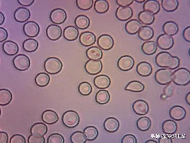 巴西布兰格斯牛和内洛尔牛中,探索双叉巴贝虫和蜱虫的季节性波动