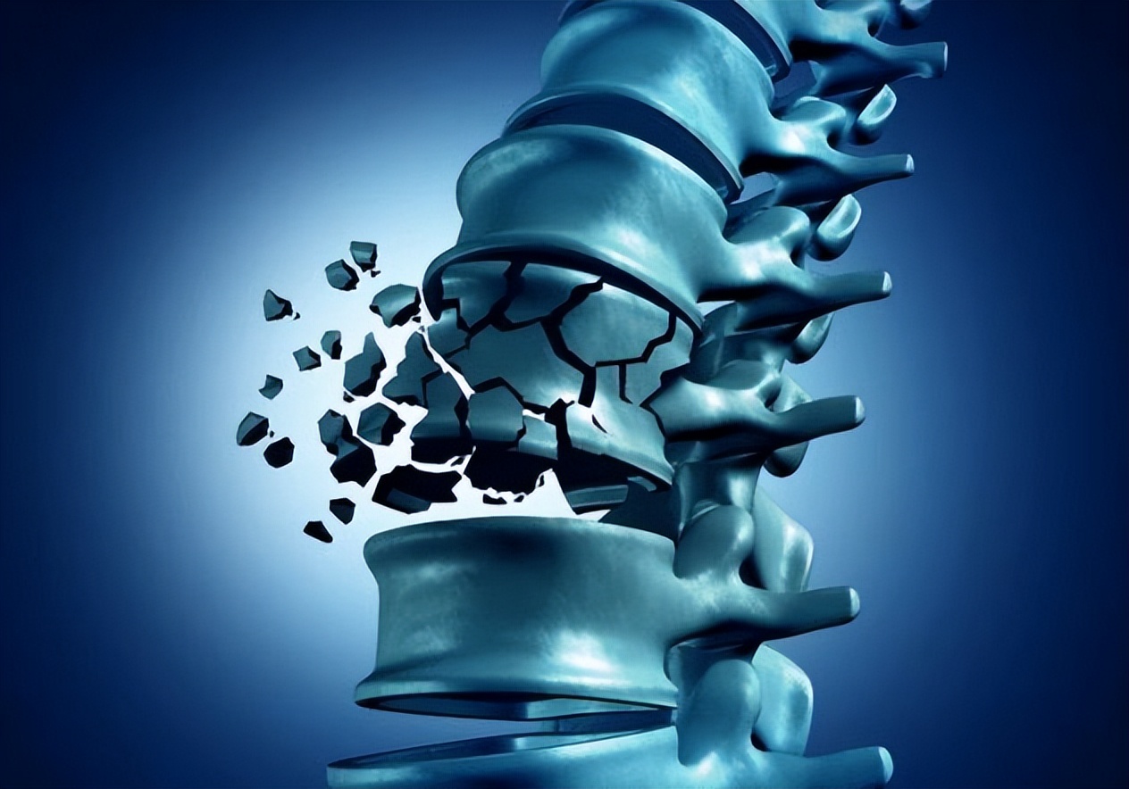 老年人为什么摔一跤会死,老年人摔了一跤该怎么办