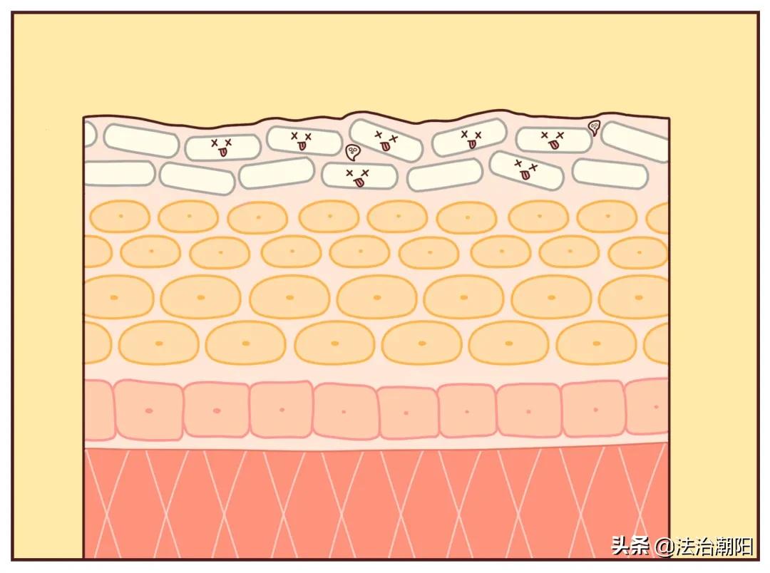 手指长倒刺缺乏哪种维生素,宝宝手指倒刺是缺什么维生素