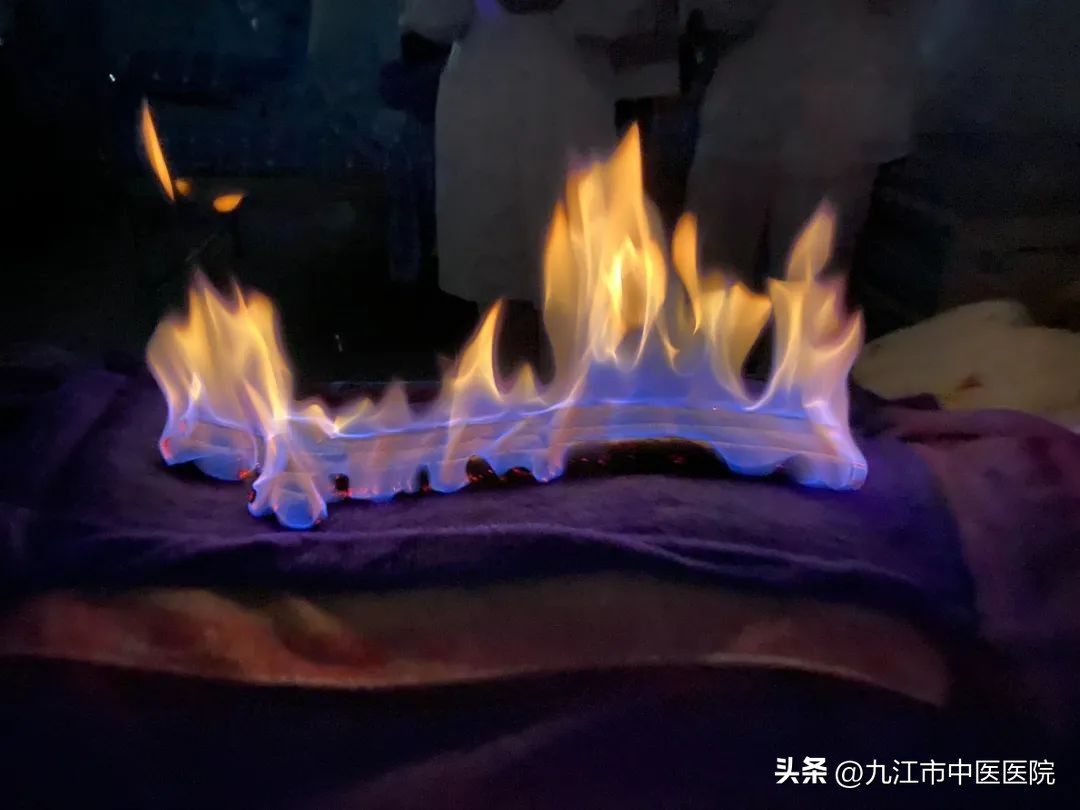 三伏养生灸团购,三伏灸惠民免费活动