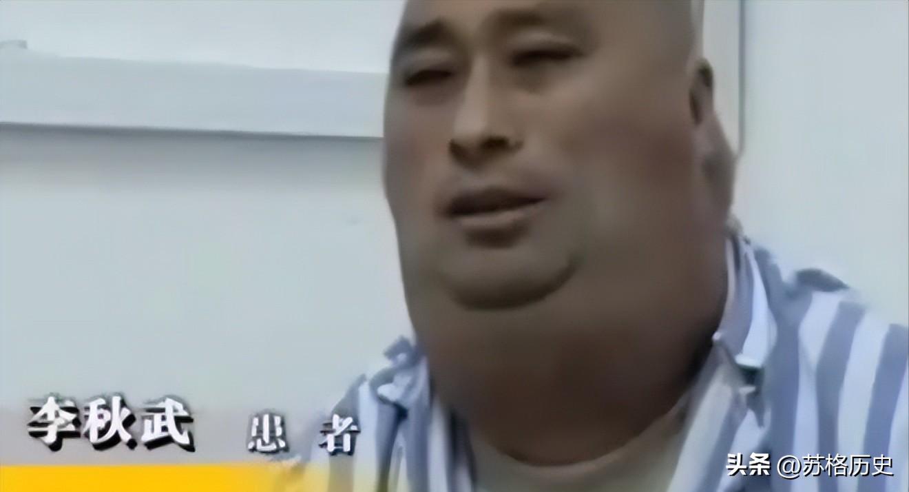 喝了40年酒结果变成河马脖,喝白酒脖子变成河马脖